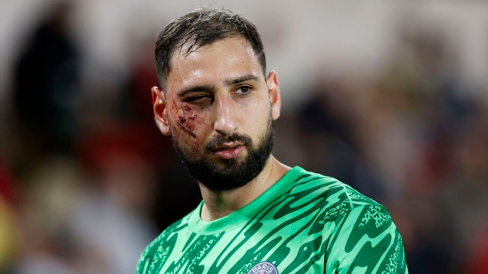 Chilling: 'Killer' tackle takes Donnarumma out of Monaco-PSG